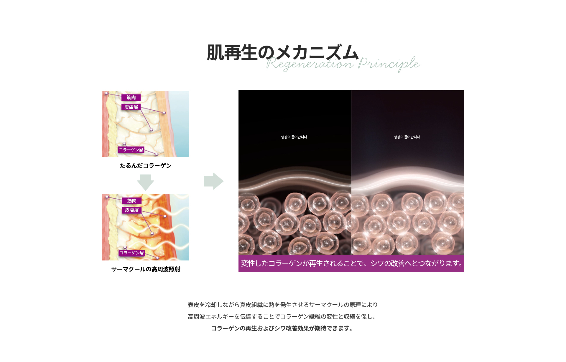 [肌再生のメカニズム] 表皮を冷却しながら真皮組織に熱を発生させることでコラーゲン繊維の変性と収縮を促し変性したコラーゲンが再生されシワの改善へつながります